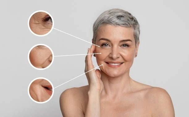 Imagen donde se hace enfasis en destacar zonas del rostro de una mujer mayor donde se puede aplicar rejuvenecimiento facial.