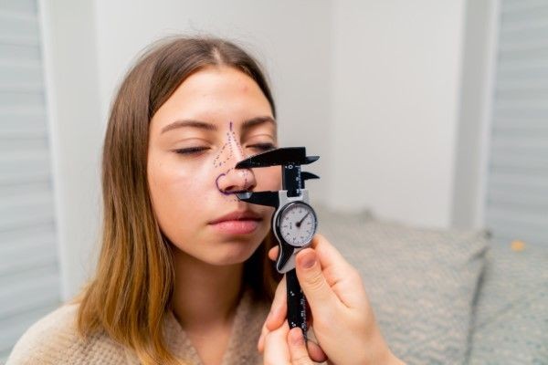 Una paciente recibiendo una asesoría de medición nasal en donde se nota que previamente se le han hecho marcas quirúrgicas.